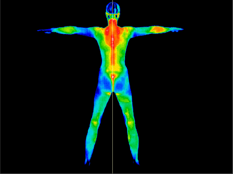 Full Body Imaging